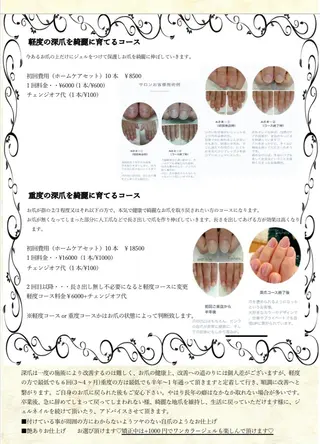 ネイル 林 禅のネイルデザイン
