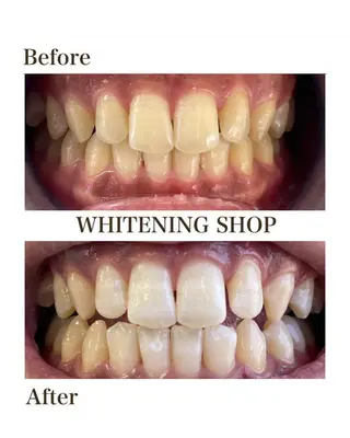 ホワイトニング ショップ津店のその他イメージ