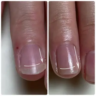 Nail ビ爪のネイルデザイン