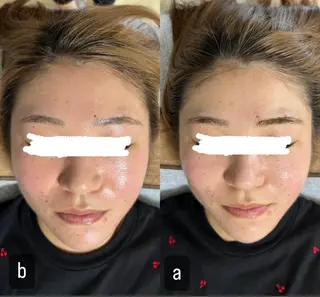 217 ホワイトニングルームのエステ・リラクイメージ