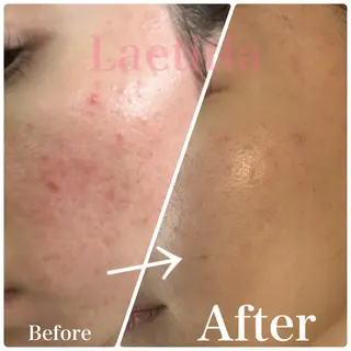 メンズ レティティア【Laetitia】所属・レティティア秋葉原店 Yoshizawaのエステ・リラクイメージ