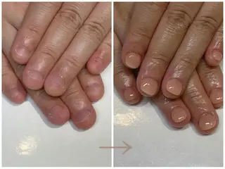 ネイル 深爪矯正・自爪育成 ヴェールリムのネイルデザイン