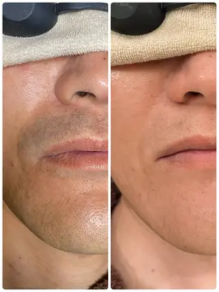 メンズ メンズガーデン 今池の眉毛・アイブロウイメージ