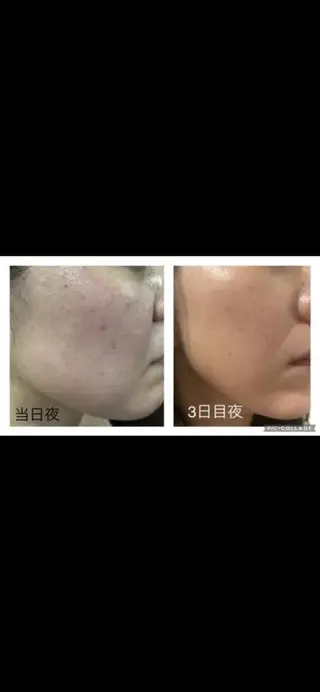 🗻エステティック RAYVIS藤🐈のエステ・リラクイメージ