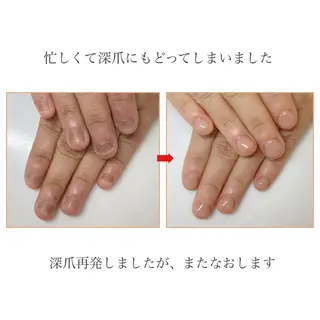 ネイル ネイルサロン アリュームのネイルデザイン