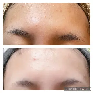 メンズ 芝田 ミチコのエステ・リラクイメージ