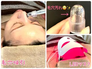 肌質改善salon♪ 効果がわかる♪南森町のエステ・リラクイメージ