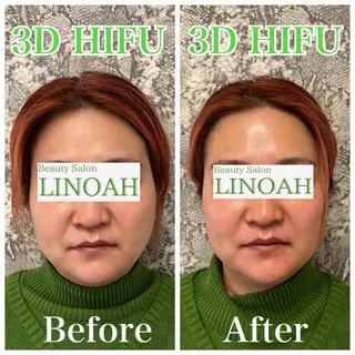 パーマ マツエク・マツパ アイブロウ メンズ ビューティーサロン リノアのエステ・リラクイメージ