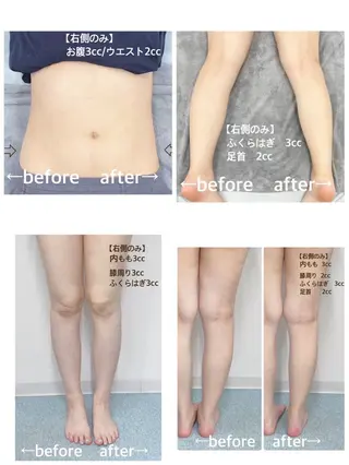 小顔痩身HALO 二宮早織のエステ・リラクイメージ