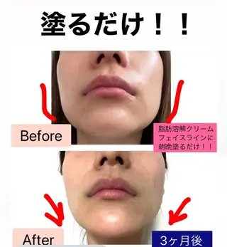 ブライダル痩身×脱毛 尼崎駅前サロンのエステ・リラクイメージ