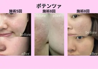 マツエク・マツパ 愛維美水光美肌専門店 メンズレディースokのエステ・リラクイメージ