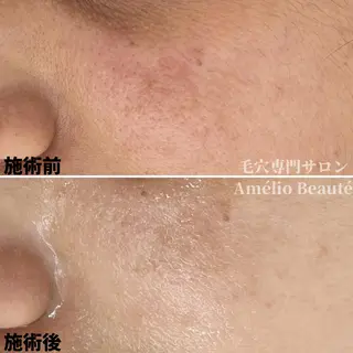 毛穴ケア専門サロン アメリオボーテのその他イメージ