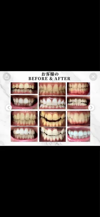 WHITENING ハウスのマツエク・マツパデザイン