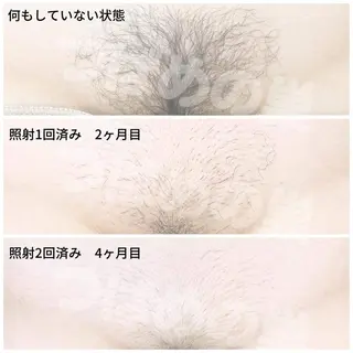 女性専用サロン つばめの巣のエステ・リラクイメージ