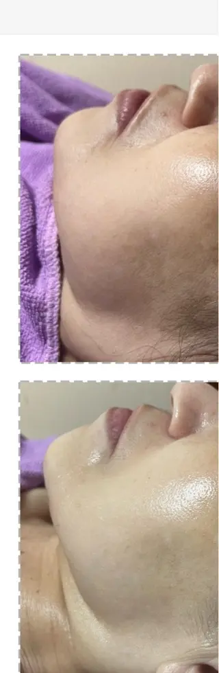 🅖🅤🅩🅔🅛 salonのエステ・リラクイメージ