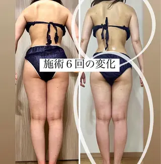 ショート カラー パーマ ヘアアレンジ メンズ キッズ ネイル マツエク・マツパ アイブロウ ‍痩身＆ボディ 結果出し🌟丹野のエステ・リラクイメージ