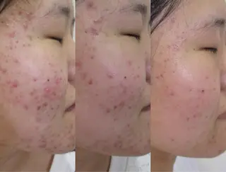 菊地 恵美のエステ・リラクイメージ