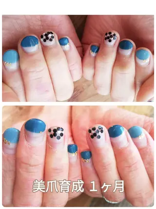 ネイル 深爪矯正/爪育成ケア manie nailのネイルデザイン