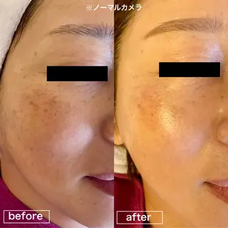 merfie メルフィーのマツエク・マツパデザイン