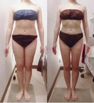 痩身・小顔・脱毛 グレイスボディのエステ・リラクイメージ