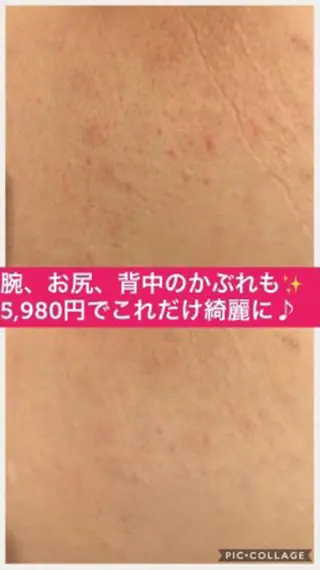 ミディアム カラー パーマ ヘアアレンジ メンズ キッズ ネイル マツエク・マツパ ニキビ・肌質改善専門 ♡人生が変わるサロンのエステ・リラクイメージ