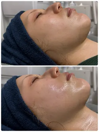 THE PEACH スタッフのエステ・リラクイメージ