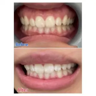 Ｍ渋谷 ホワイトニングのエステ・リラクイメージ