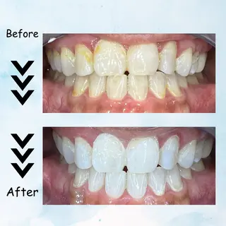 ネイル セルフホワイトニング エクシア塩釜口駅前店のその他イメージ