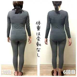 小顔モニター 募集のエステ・リラクイメージ