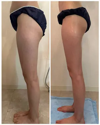 アプローズ所属・恵比寿/小顔/痩身 アプローズのエステ・リラクイメージ