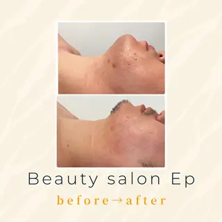 beauty salon epのエステ・リラクイメージ