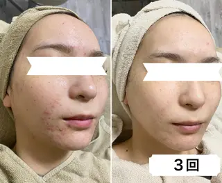 NOBLE 新宿南口店のエステ・リラクイメージ