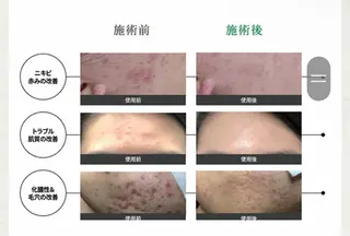 フルフィル名取美田園 MIYUKIのエステ・リラクイメージ