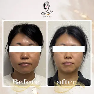 💎allilin 五所川原💎本間のエステ・リラクイメージ