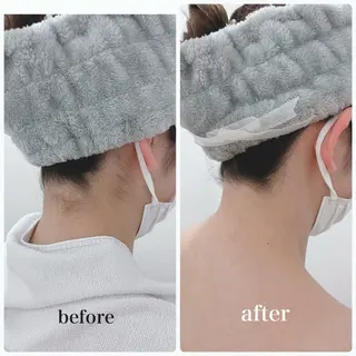 medical salon de off 堺東店所属・メディカルサロンド オフ🧸YUSAのエステ・リラクイメージ