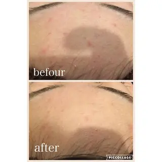 ニキビ跡専門サロン Ainaのエステ・リラクイメージ