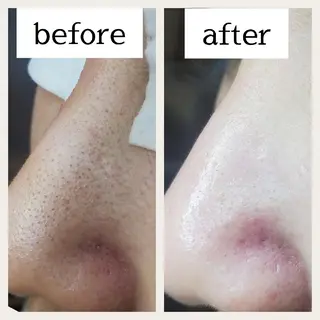 毛穴専門店 マカナアロハのエステ・リラクイメージ