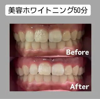 Kaula ホワイトニング🦷✨のエステ・リラクイメージ