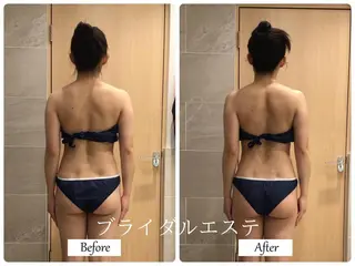 ブライダルサロン ｜Lino【堀江】のエステ・リラクイメージ