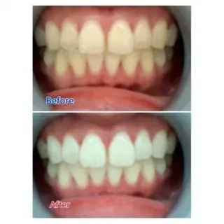 Ｍ渋谷 ホワイトニングのエステ・リラクイメージ