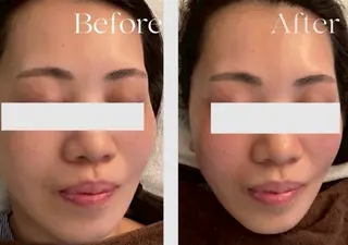 村松/ 小顔,ボディケアのエステ・リラクイメージ