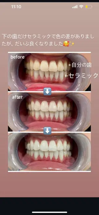 セルフホワイトニング エクシア秋田大町店のその他イメージ