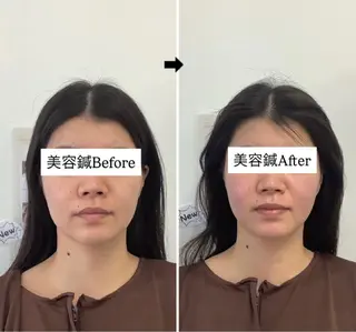 hari salon de off　美容鍼灸×小顔整体【ハリサロンドオフ】所属・美容鍼灸×小顔整体♡ ハリサロンドオフ堺東のその他イメージ