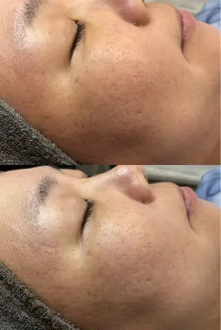 シミケア専門店モルセラ所属・シミケア専門店 モルセラのエステ・リラクイメージ