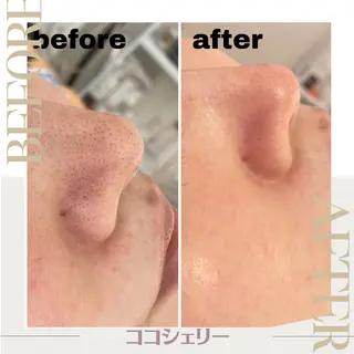 エステサロン シェリーのエステ・リラクイメージ