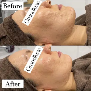 ハーブピーリング綺肌銀座店所属・ハーブピーリング綺肌 KIKI銀座店のエステ・リラクイメージ