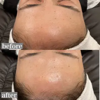 Red Moat所属・Red Moatのマツエク・マツパデザイン