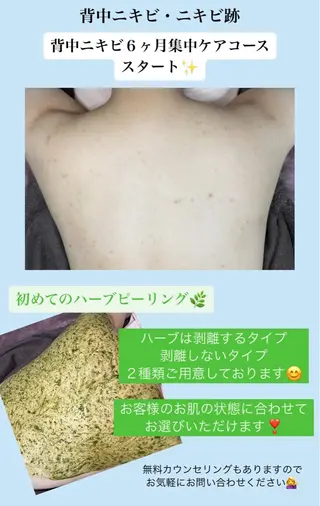 ベラージュ【美背中・ 美尻・フェイシャル】のエステ・リラクイメージ