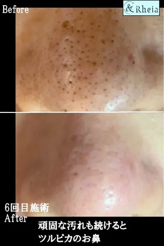 メンズ kawashima mariの眉毛・アイブロウイメージ