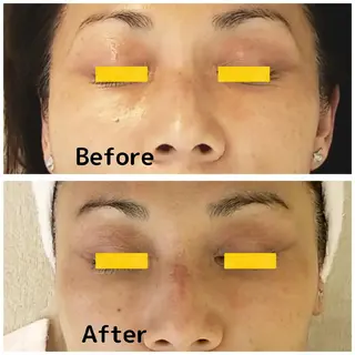 自然派フェイシャル やながわのエステ・リラクイメージ